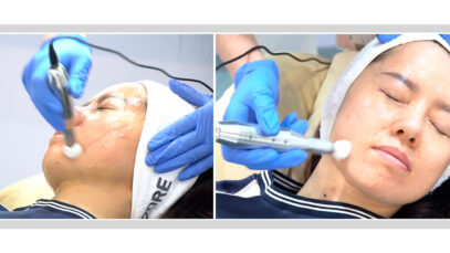 6-14-TRATAMIENTO-04-PLAY